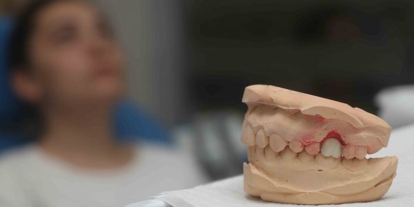 Elazığ Ortodontik Tedavi
